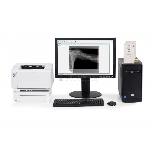 Мобильный цифровой рентгенодиагностический комплекс «Доминанта» для неонатальных исследований на базе аппарата АРА 110/160-02 с АРМ и плоскопанельным детектором