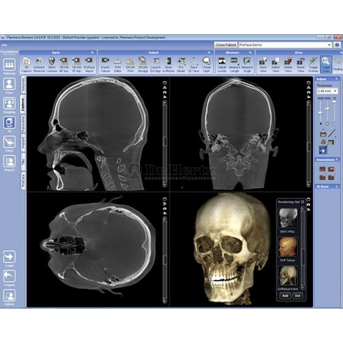 Томограф KaVo 3D eXam