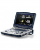 Портативный ультразвуковой аппарат GE LOGIQ V2