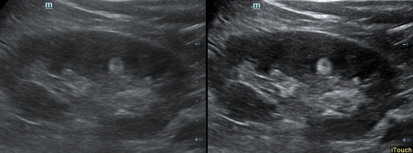 itouch узи mindray