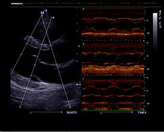 mindray m7 free xros m