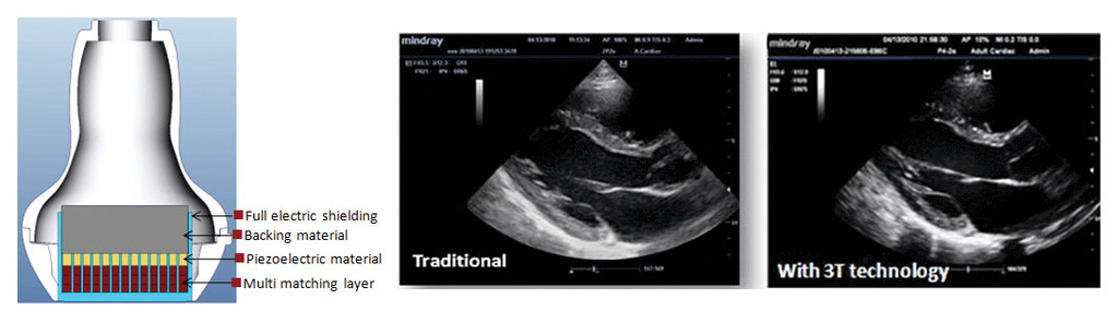 mindray датчики на основе 3Т технологий