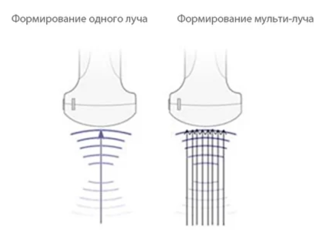 mindray m7 мульти-луч